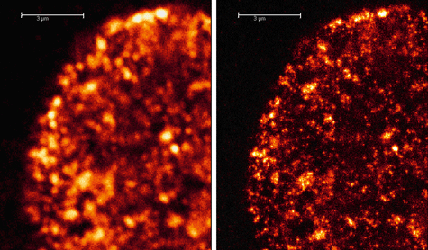 Confocal and STED microscopy images of cells stained with Histone H3 trimethyl Lys27 rabbit polyclonal antibody and ATTO 655 STED Goat anti-rabbit IgG