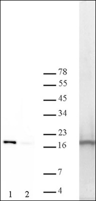 Kinase assay