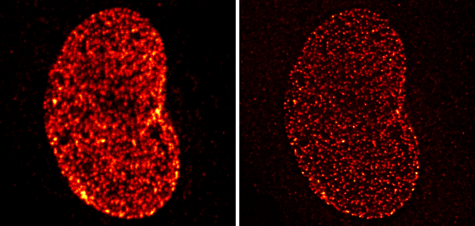 Confocal and STED microscopy images of cells co-stained with NUP-1 and Chromeo 488 Goat anti-mouse IgG
