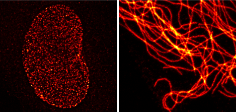 STED microscopy images of cells stained by Nuclear pore protein-1 antibody with Chromeo 488 Goat anti-mouse IgG, and vimentin antibody with Chromeo 488 Goat anti-rabbit IgG