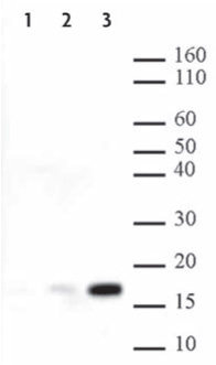 Western Blot.