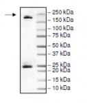 DNMT1 Coomassie gel