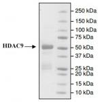 HDAC9 protein Coomassie gel