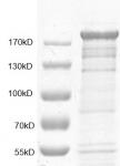 PRDM10 Coomassie gel