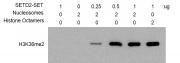 HMT Assay for Recombinant SETD2 (1392-2564) protein activity.