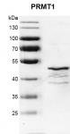 PRMT1 Coomassie gel