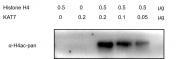 KAT7 protein activity assay
