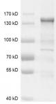 HDAC6 protein Coomassie gel