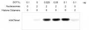 Histone Methyltransferase (HMT) Assay - Recombinant Polynucleosomes H3.3 