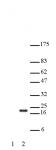 Histone H3K27ac antibody (pAb) tested by Western blot.