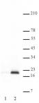 Histone H3K9ac antibody (pAb) tested by Western blot.