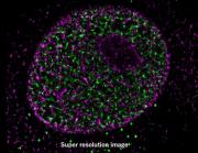 Histone H3 trimethyl Lys9 antibody (pAb) images using HM-1000 microscopy.