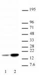 Histone H3K18ac antibody (pAb) tested by Western blot.
