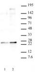 HP1 gamma phospho Ser93 antibody (pAb) tested by Western blot.