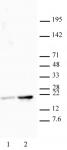 Histone H3K18ac antibody (pAb) tested by Western blot.