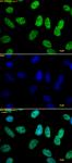 Histone H3K18ac antibody (pAb) tested by immunofluorescence.