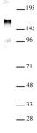 EuHMT1 antibody (pAb) tested by Western blot.