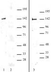 HDAC9 antibody (pAb) tested by Western blot.