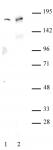 AIB1 / SRC-3 antibody (pAb) tested by Western blot.
