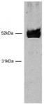 HNF-3β / FOXA2 antibody (pAb) tested by Western blot.