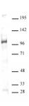 GCN5 antibody (pAb) tested by Western blot.