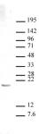 Histone H3K27me1 antibody (pAb) tested by Western blot.