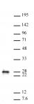 MGMT antibody (pAb) tested by Western blot.