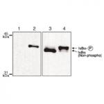 I&kappa;B&alpha; phospho Ser32,36 antibody (mAb) tested by Western blot.