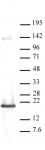 HMGA2 / HMGI-C antibody (pAb) tested by Western blot.