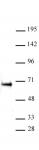 ETO / RUNX1T1 antibody (pAb) tested by Western blot.