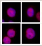 JMJD2B / KDM4B antibody (pAb) tested by immunofluorescence.
