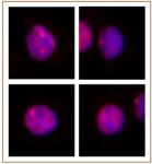 MLL / HRX antibody (pAb) tested by immunofluorescence.