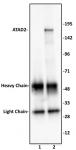 ATAD2 antibody (pAb) tested by immunoprecipitation.