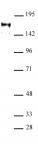 ATAD2 antibody (pAb) tested by Western blot.
