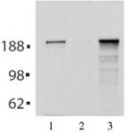 Tet2 antibody (mAb) tested by immunoprecipitation.