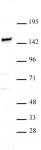 SMARCC1 / BAF155 antibody (pAb) tested by Western blot.