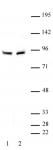 beta-Catenin antibody (pAb) tested by Western blot.