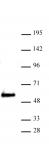 SMARCE1 antibody (pAb) tested by Western blot.