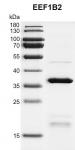 Recombinant EEF1B2 protein gel