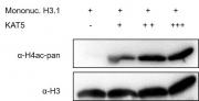 Western blot for Recombinant KAT5 protein activity