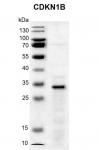 Recombinant CDKN1B protein