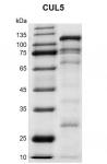 Recombinant EPHB4 (561-987) protein