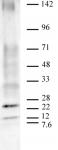 AbFlex<sup>&reg;</sup> Ubiquitin antibody (rAb) tested by Western blot.