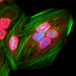 Acetyl-Lysine antibody (rAb) tested by immunofluorescence.