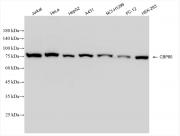 CBP80 antibody (rAb), 100 µg tested by Western blot.