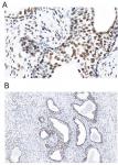 CREB1 phospho Ser133 (rAb), 100 µg tested by immunohistochemistry.
